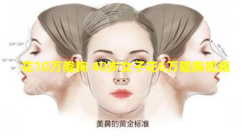 花10万隆胸 40岁女子花6万隆胸视频